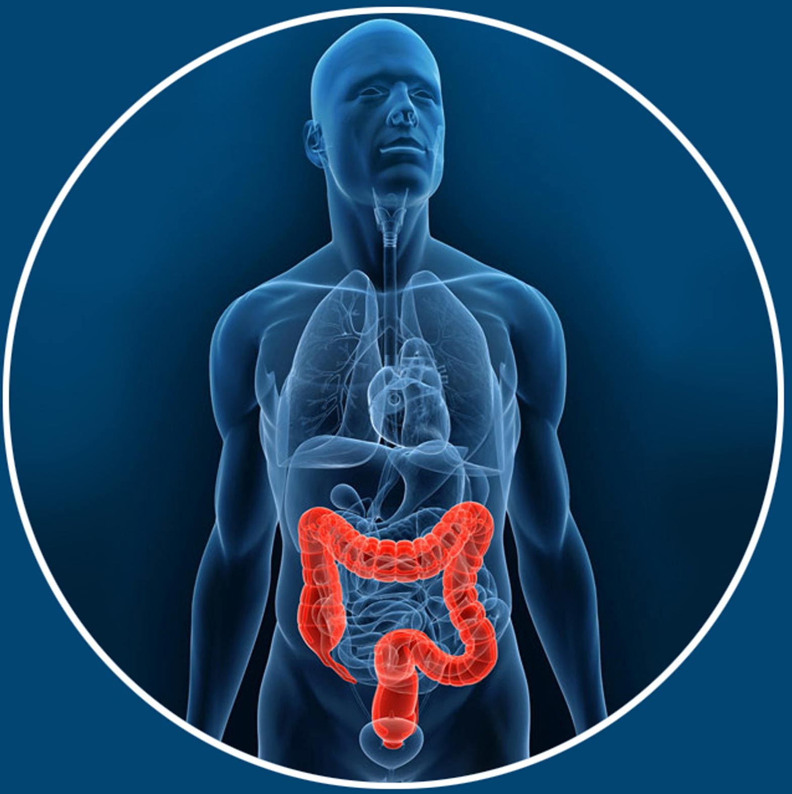 cancer du colon et de l’estomac. Irritation du colon - Consultation DR Juan AMARIS spécialiste gastro-enterologie